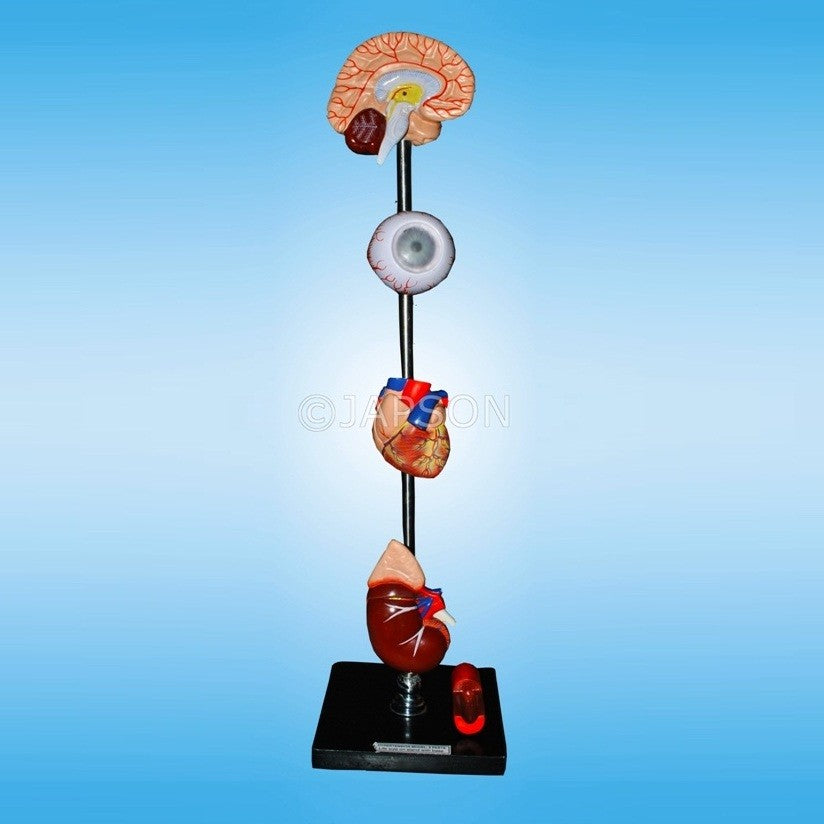 Human Hypertension Model, 6 Parts Human Hypertension Model, 6 Parts